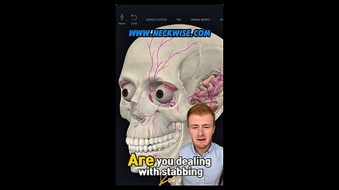 Why do I have stabbing pain in my face? | rifleman neuralgia | upper cervical chiropractor