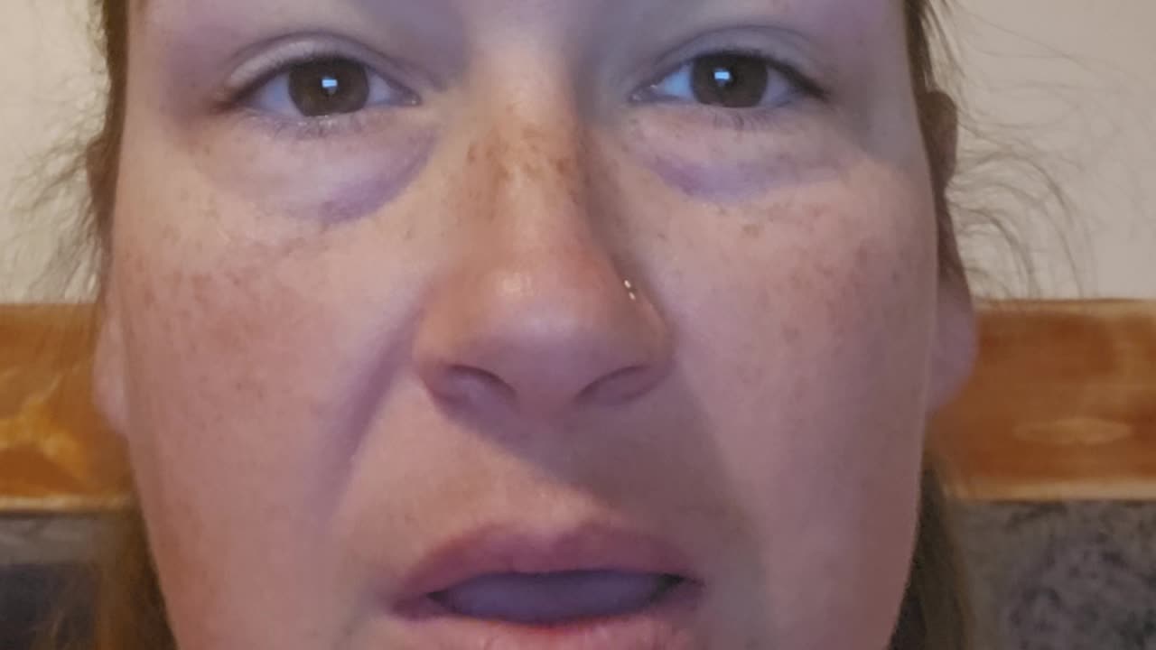 The Cross & Resurrection — Victory Over Sin and Death