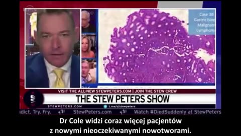 Dr David Martin Eksplozja nowotworów zawałów i chorób po zastrzykach na Covid Lektor PL