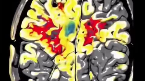 🟪🟡THIS SOUND WILL RESET YOUR BRAIN🟪🟡