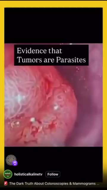 Colonoscopy & Mammography EXPOSED - Dr Leonard Coldwell