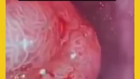 Colonoscopy & Mammography EXPOSED - Dr Leonard Coldwell