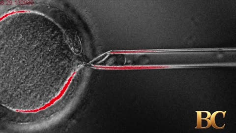 Scientists use cloning technology to swap DNA in human eggs
