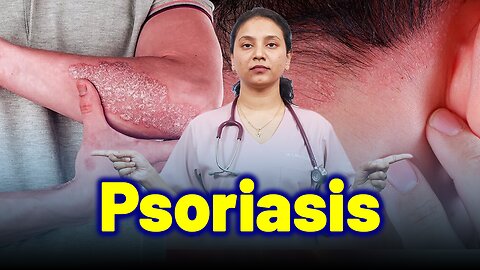 Psoriasis,Chronic Plaque,Erythrodermic,Guttate,Pustular . | Treatment & Cure | Homeopathy, Medicine.