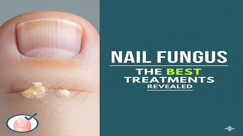 Nail Fungus: The Best Treatments Revealed