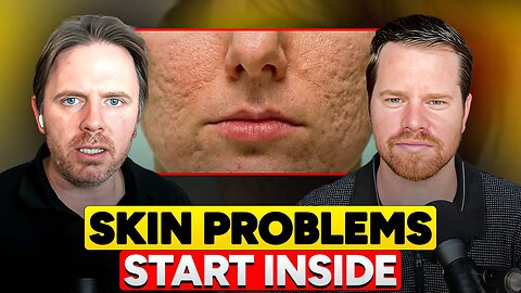 Adult Acne Explained by Gut Inflammation & Infections