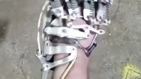 An engineer builds his own prosthetic after insurance refused to cover one