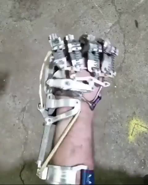 An engineer builds his own prosthetic after insurance refused to cover one
