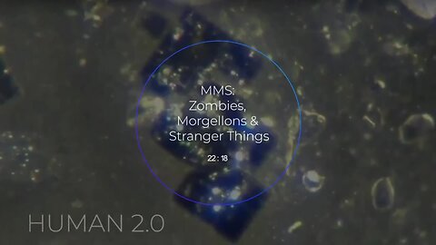 S4 95. ENOCH P ~ ZOMBIES, MORGELLONS & STRANGER THINGS