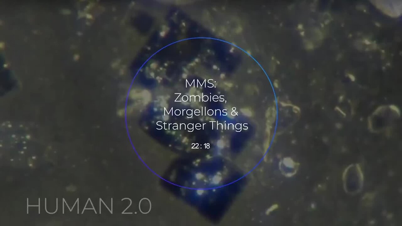 S4 95. ENOCH P ~ ZOMBIES, MORGELLONS & STRANGER THINGS