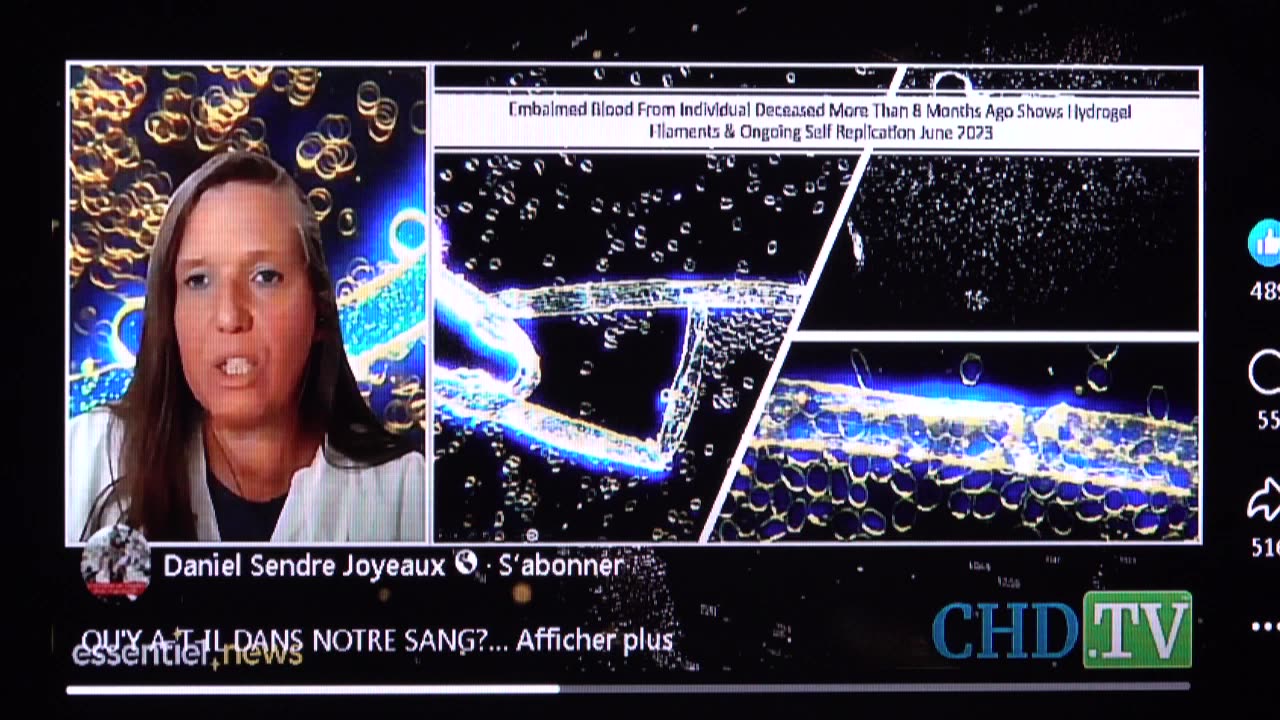 R.P.V. Video Reporter