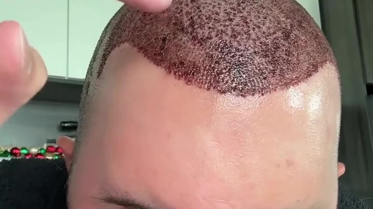 🤯 Dr. Egghead's Unbelievable Antics! | FunFM