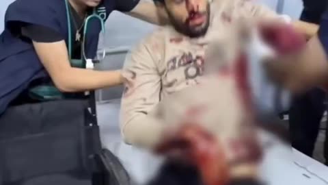 A Palestinian was killed and another injured