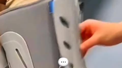 Distal Fibula Plating Surgery Explained