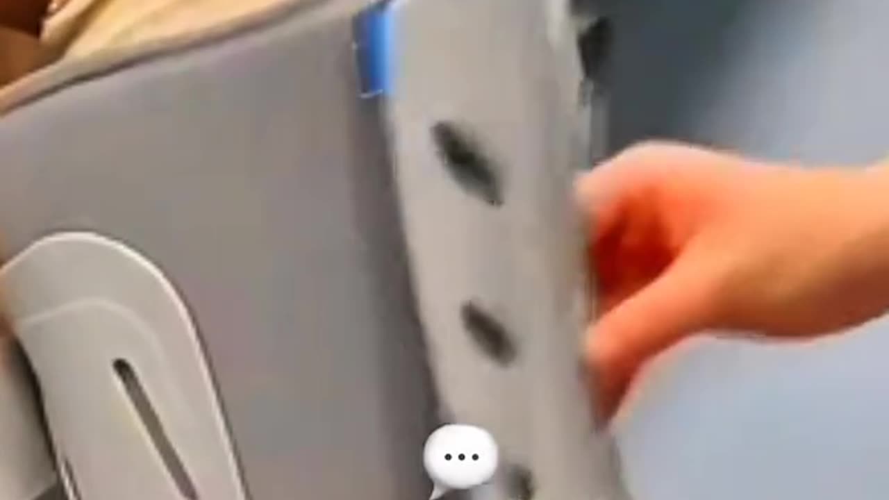 Distal Fibula Plating Surgery Explained