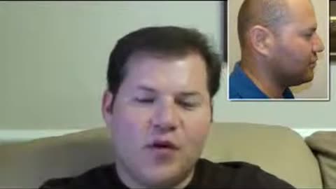 From Balding to Confident | Real Hair Transplant Testimonial by Dr. Brett Bolton’s Patient