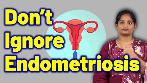 What Happens If You Neglet Pelvic Endometriosis | Treatment Cure Medicine Surgery | Gynaecology