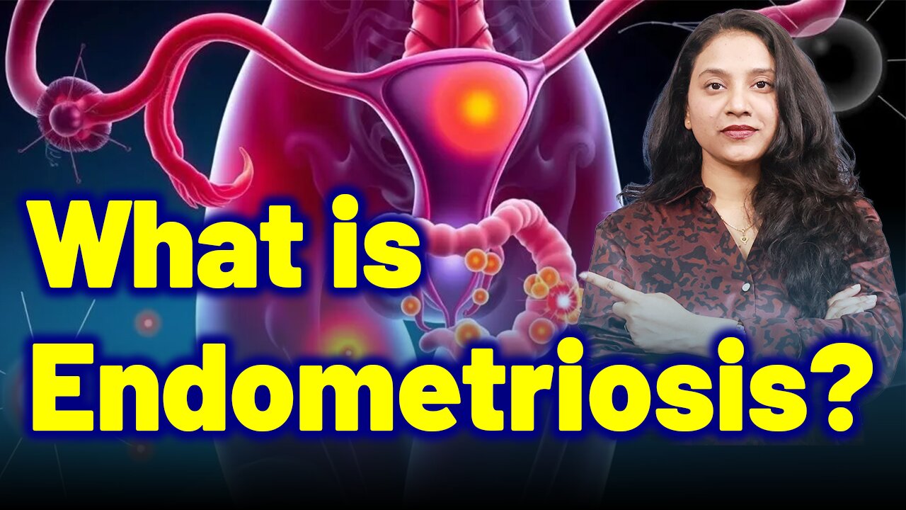 What is Endometriosis ? | Treatment & Cure | Homeopathy, Medicine & Surgery