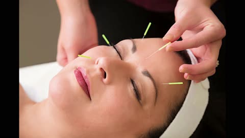 Healing with Acupuncture