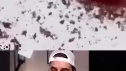 Dr. Ryan Cole - What jabs do to blood under the microscope