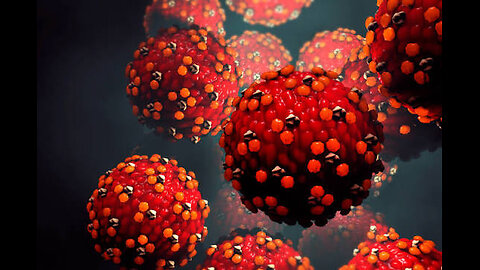 Failed hospital treatment they didn’t died of measles and exclusive interview Cheryl Hines