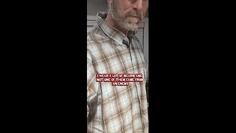 I wear a lot of scars.