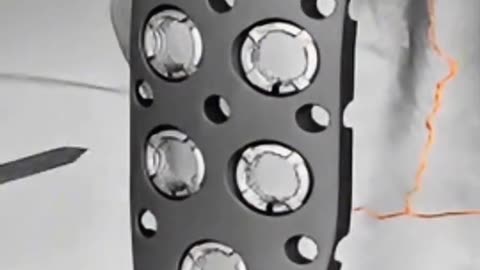 Humerus Plating Surgery — Fixing a Broken Upper Arm Bone