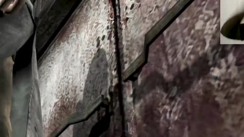 Nah... I'll QUIT After That 🤕