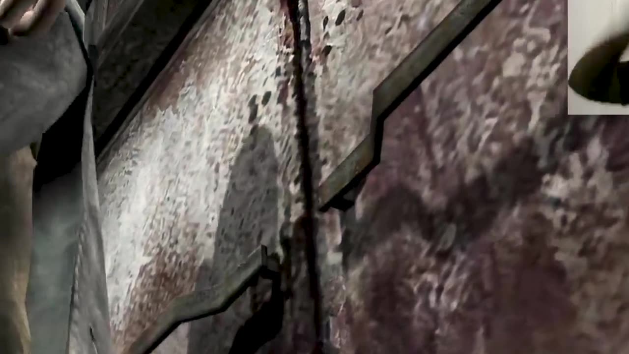 Nah... I'll QUIT After That 🤕