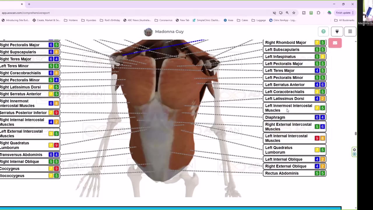 Sharing my scans & symptoms - Solex BioResonance with AI support, supplements, empowerment...