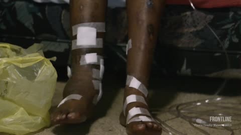 AN INCONVENIENT STUDY - Vaxxed Kids +560% Cronic Illness Vs Unvaxxed