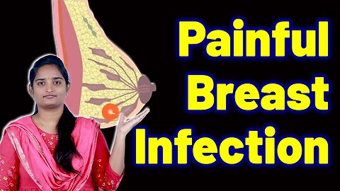 What Is Breast Abscess, Breast Infection, Pus-Filled Breast Lump, Breast Boil | Homeopathy Medicine