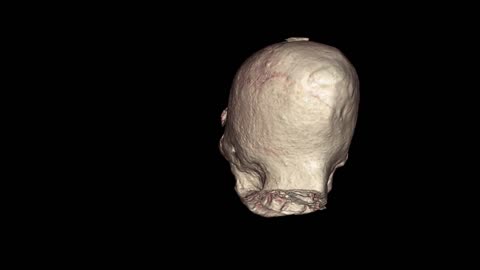 👽🖼️ Montserrat's Face Revealed in Stunning DICOM Footage! | TheTruthAbove