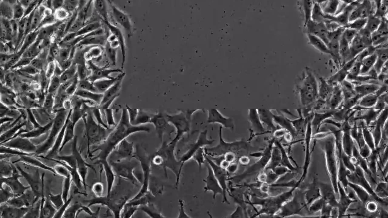 🧠✨ Early vs Late Stage Cancer Cells Migration! | FeedMyCuriosity