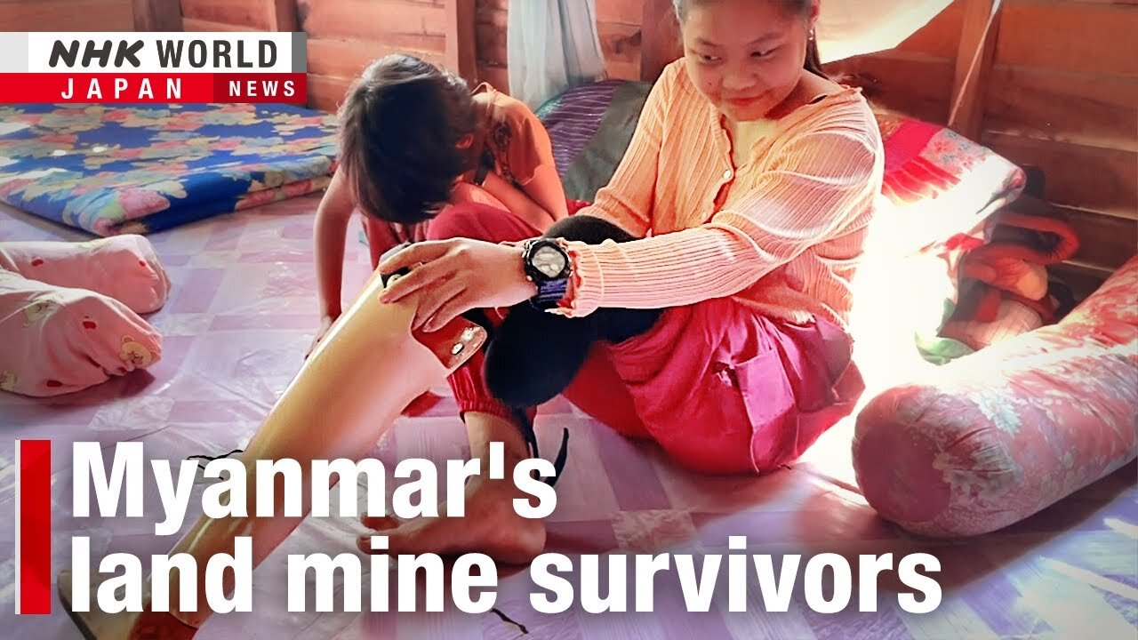 Thai clinic rebuilding lives of Myanmar’s land mine survivorsーNHK WORLD-JAPAN NEWS