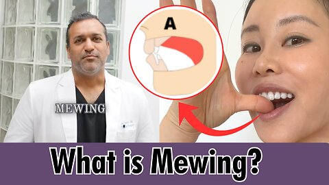 What is mewing clinical study