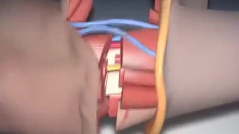 Human Hand Transplant Surgery 3D Animation