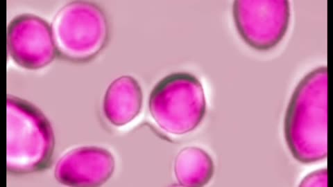 Doctors Warning about Canadian Fungus