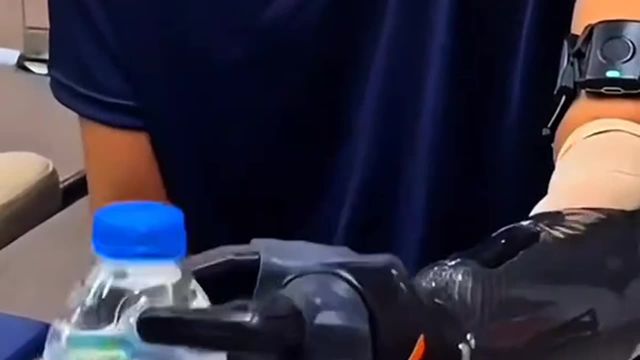 How This Ionic Arm Works Will Blow Your Mind!