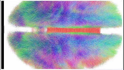 Largest Brain Map Ever Made Showing Every Neuron and Connection