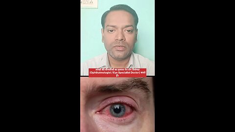 आंखों की बीमारियों का इलाज किस डॉक्टर से कराएं