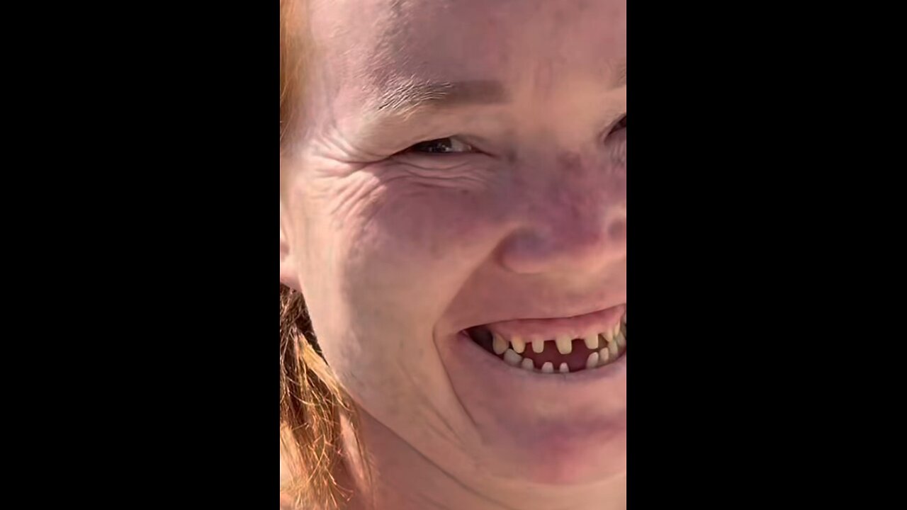 “Before & After 💇♀️✨