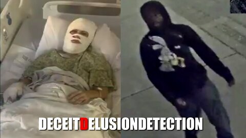 A Savannah white woman was left with third-degree burns after a random black man intentionally threw an unknown chemical on her near Forsyth Park