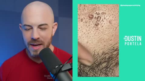Must Watch: Dermatologist's Reaction to Viral TikToks | Dr Dustin Portela