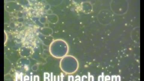 Kondycja krwi kontra 5 G