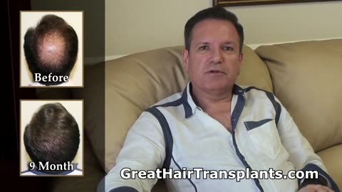 Amazing Hair Restoration Transformation by Dr. Brett Bolton