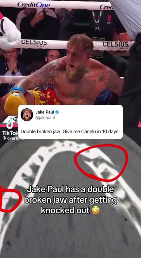 Bizarre, Brutal Fight: Jake Paul Suffers Double Broken Jaw