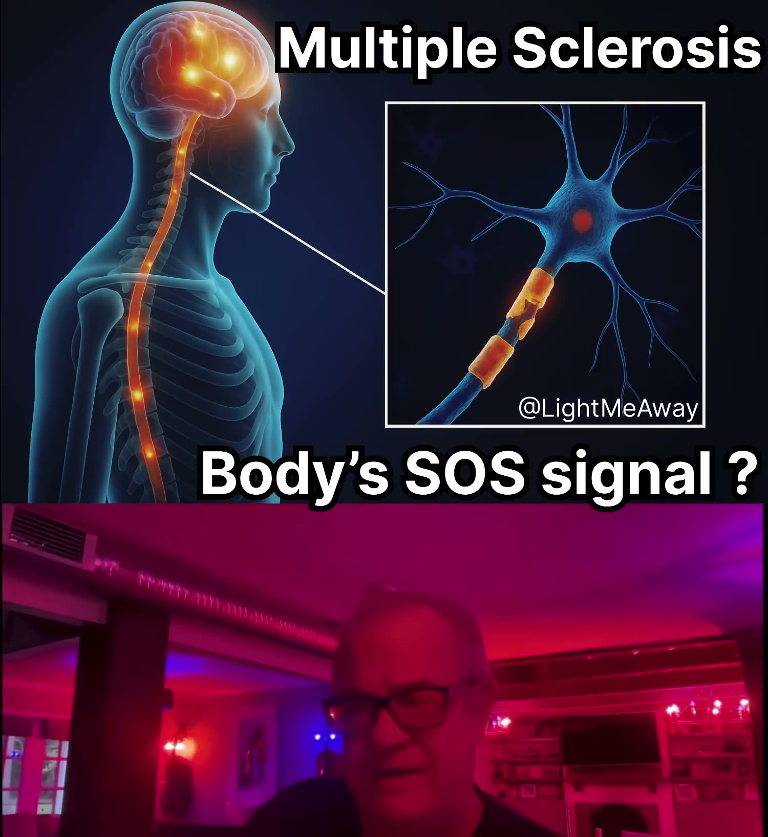 ⚡️ MS is not a “disease,” and not even a true “disorder.” So what is it? 🤔