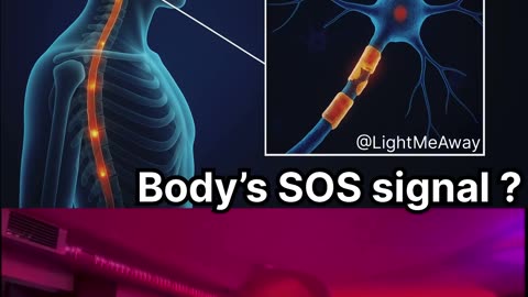 ⚡️ MS is not a “disease,” and not even a true “disorder.” So what is it? 🤔