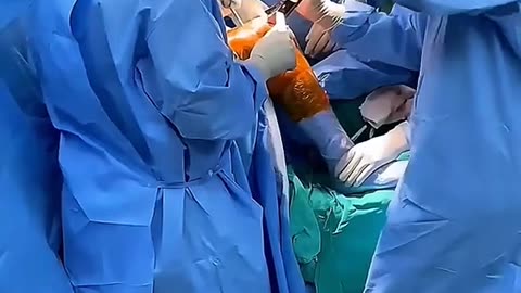 Can’t Walk Without Pain See How Knee Replacement Surgery Changes Lives!